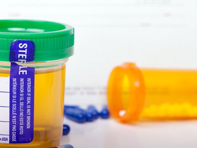urine drug test and pill bottle in background